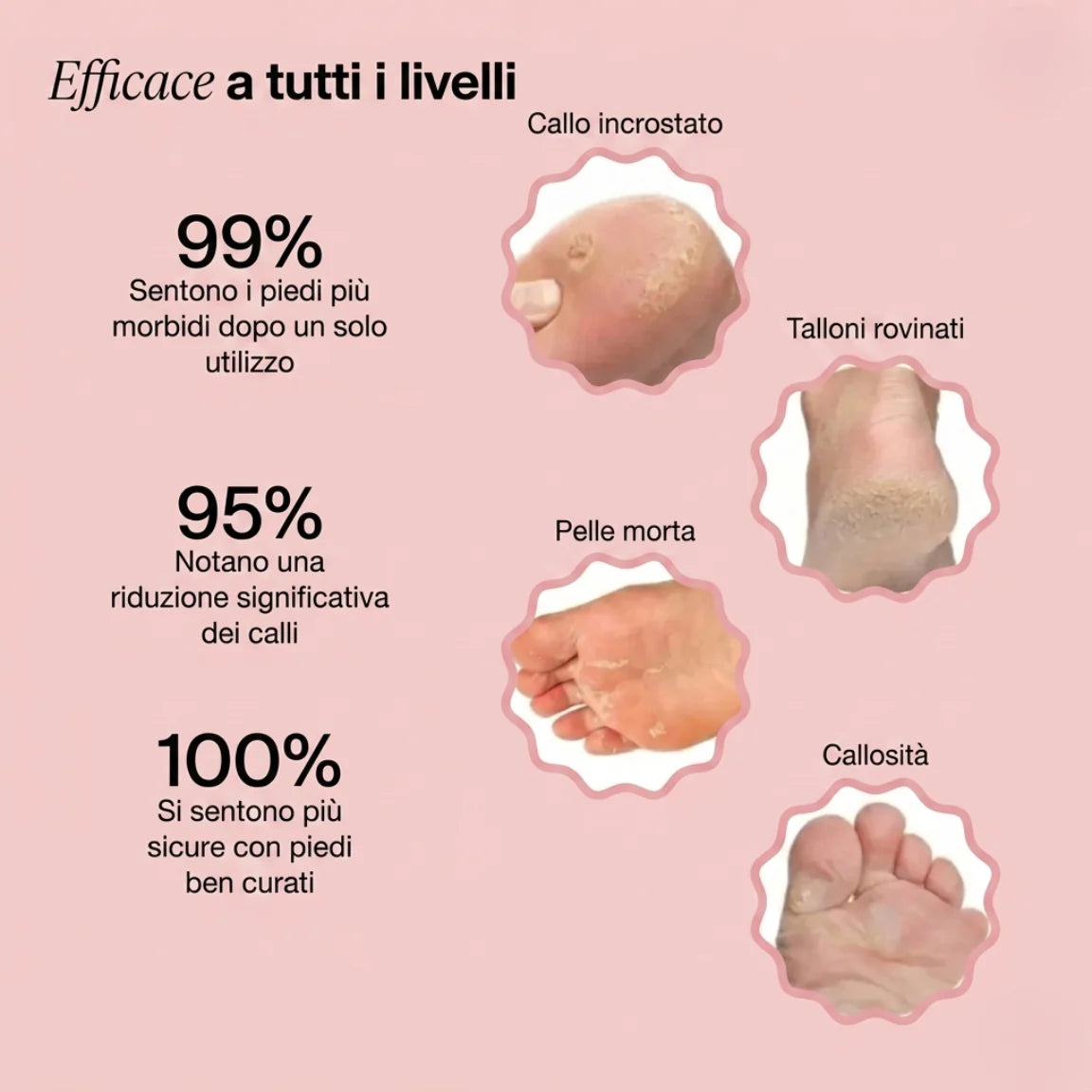Sovalya Levigatrice Elettrica per i Piedi