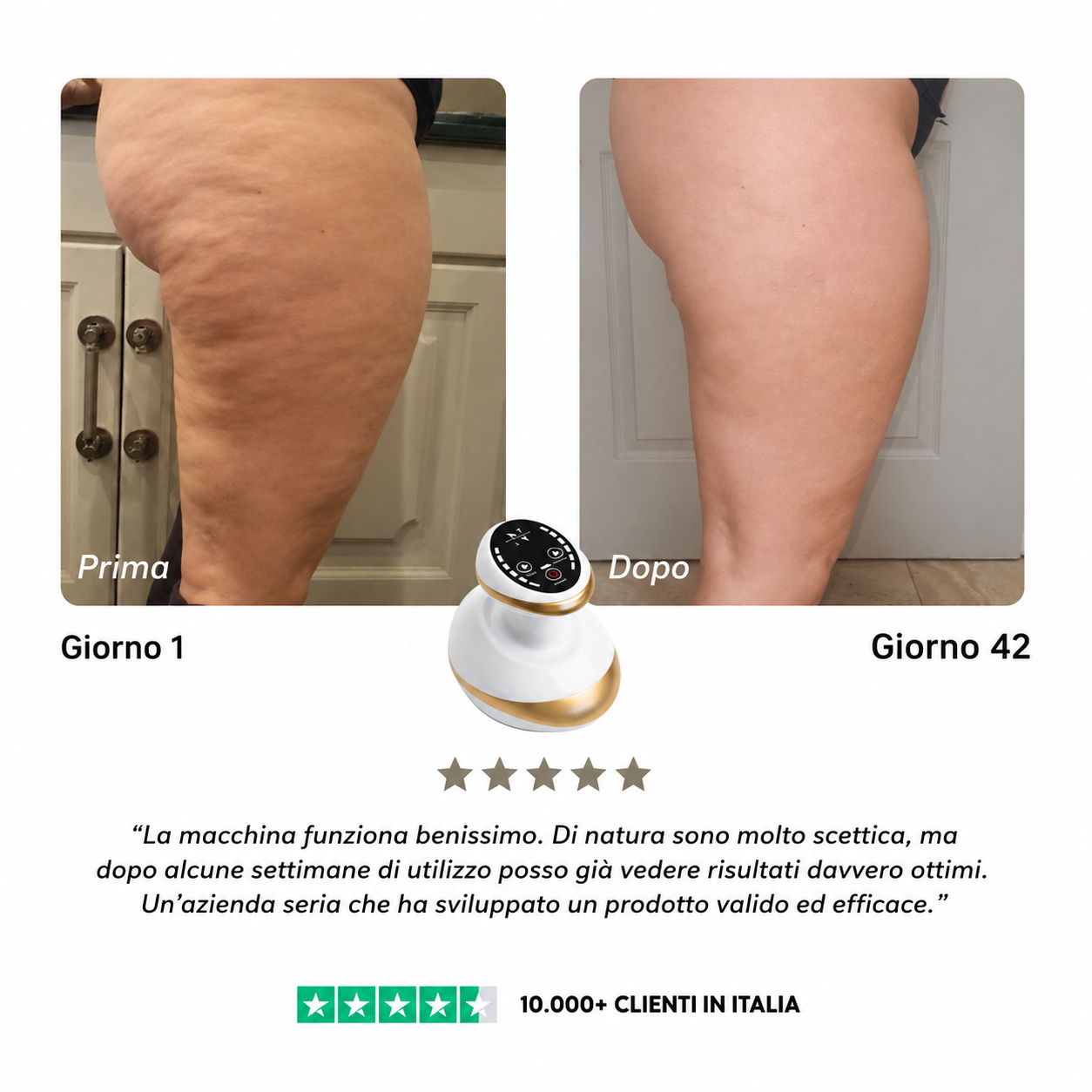CelluSmooth™ Dispositivo per massaggi