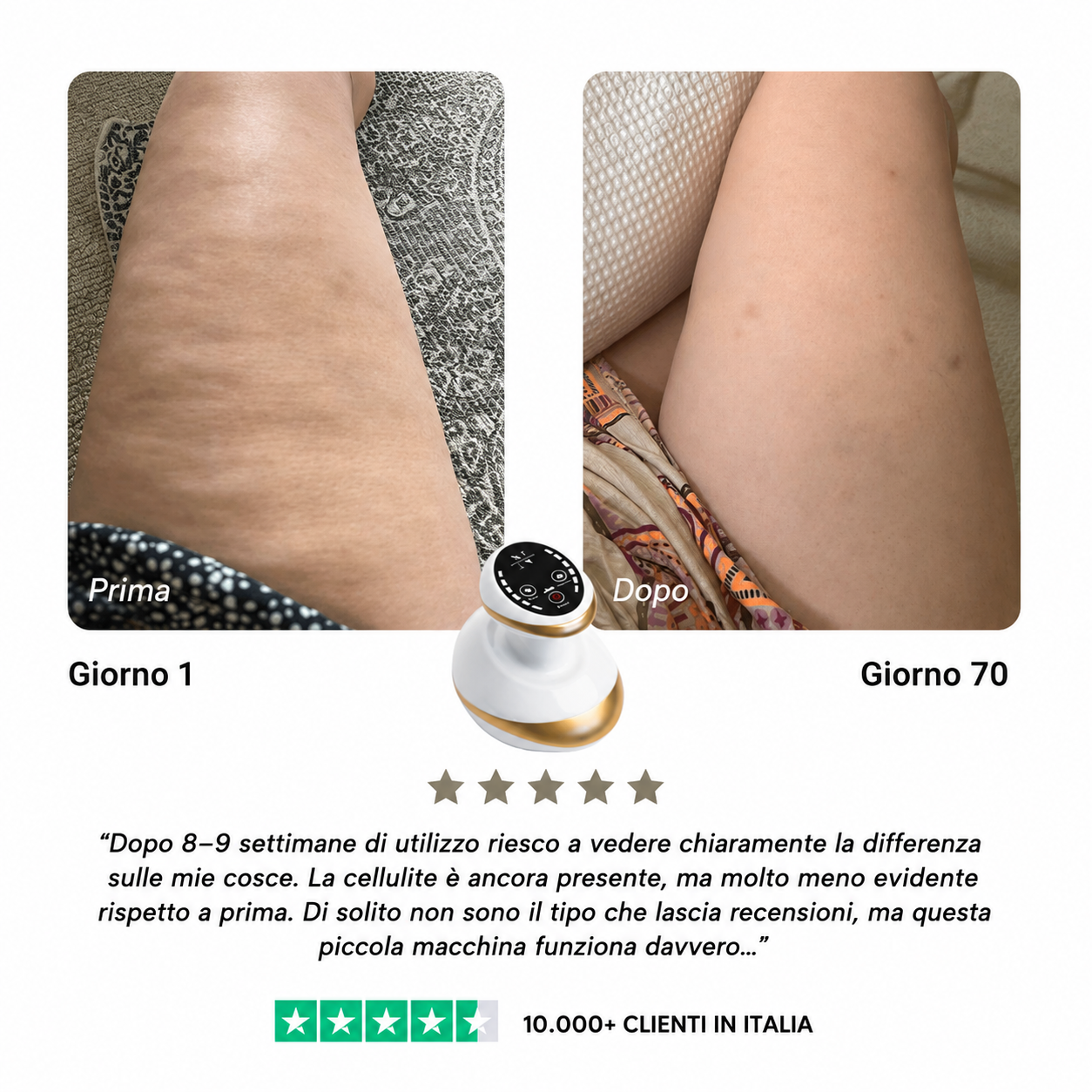 CelluSmooth™ Dispositivo per massaggi