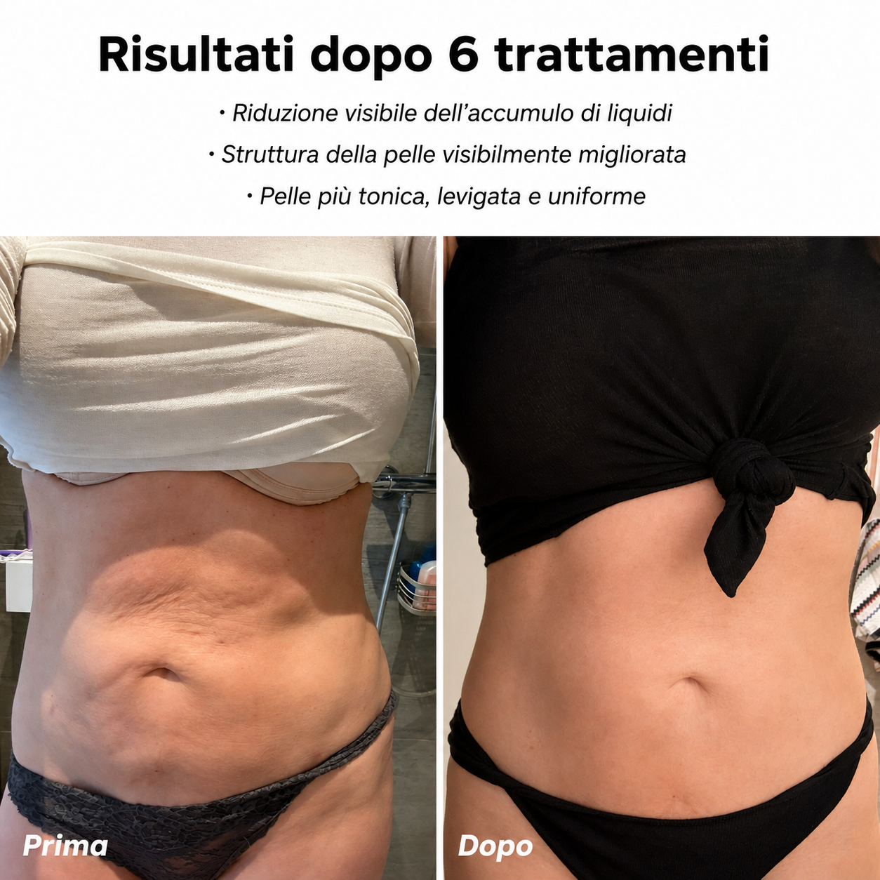CelluSmooth™ Dispositivo per massaggi